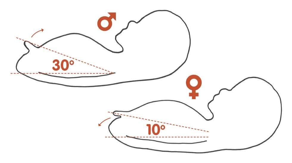 Genitaalikyhmy sijaitsee kehittyvän sikiön jalkojen välissä ja on nähtävissä ultraäänikuvissa. Sen ja selkärangan muodostaman kulman perusteella voidaan yrittää määrittää sikiön sukupuolta: yli 30 asteen kulma on yleensä pojan merkki, alle 10 asteen kulma puolestaan tytön. Kuva: Elin Wilson