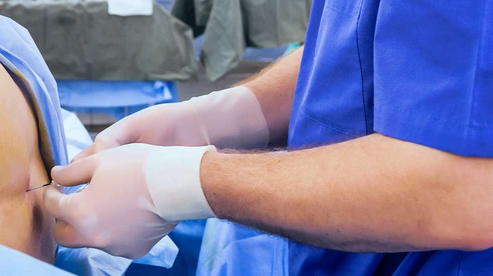 Epiduraalin laittaa anestesialääkäri. (Kuva: Shutterstock)
