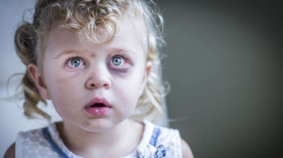 Lapsen kurittaminen vahingoittaa lasta, vaikka lapsi ei saisi mustaa silmää. (Kuva: Crestock)