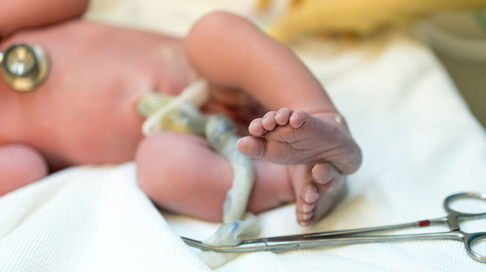 Vauva on syntynyt, ja täysin palvellut napanuora jää tarpeettomaksi. (Kuva: iStock)
