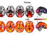 aivokuva_lsd