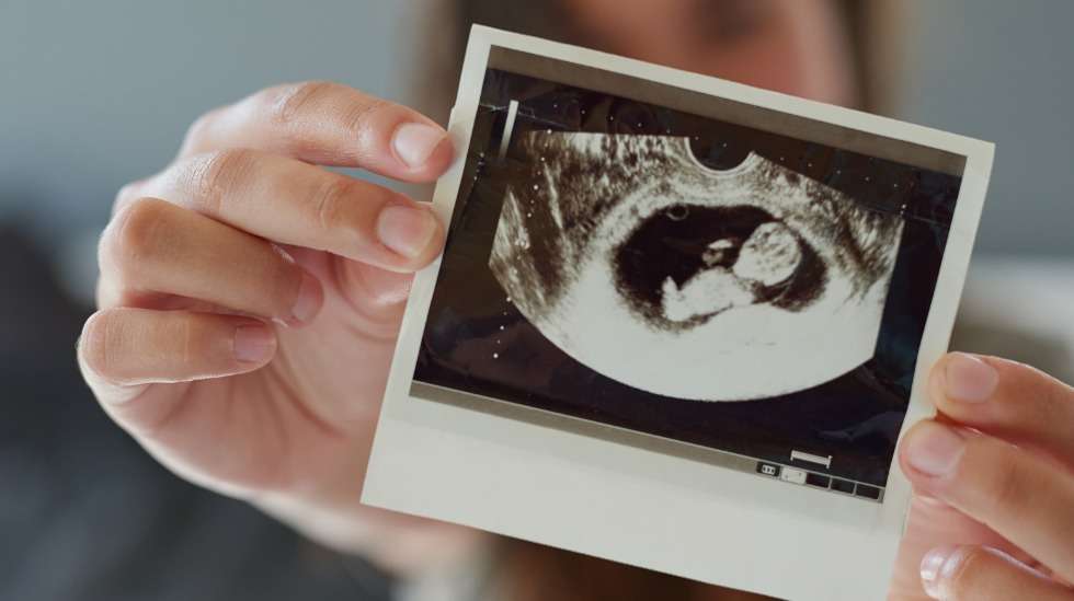 Raskausviikko 14: Pääsimme käymään NT-ultrassa ja ihastelemaan pikkuista Nyyttiämme – ihmeellistä! Kuva: iStock