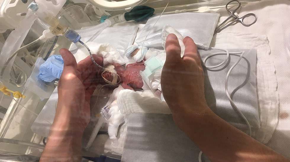 268 grammaa – uusi maailmanennätys. Kyseessä on maailman pienimpänä syntynyt poika, joka on päässyt terveenä kotiin. Kaikki kuvat: Keio University Hospital