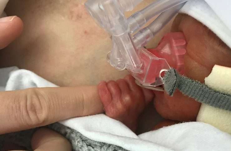 Rolf painoi vain 810 grammaa: syntyi pikkukeskosena raskausviikolla 25+1