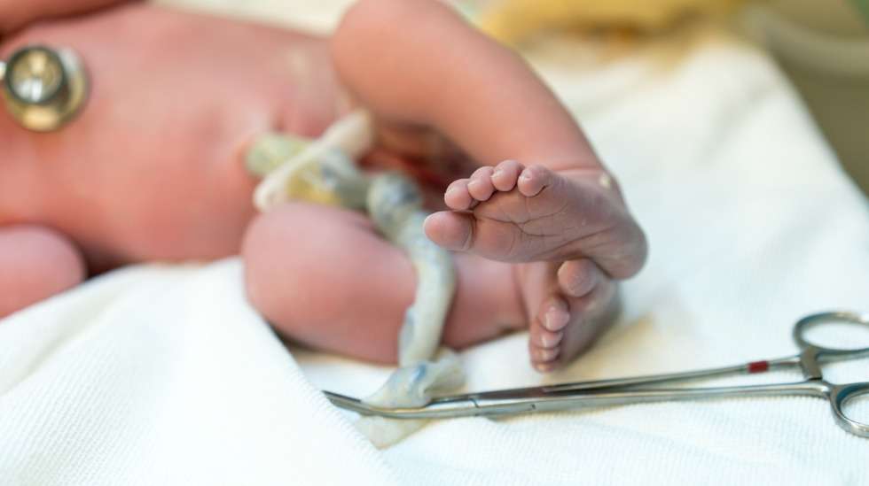Yksivaltimoinen napanuora on varsin yleinen raskauden aikainen rakennepoikkeama: se löytyy noin 0,5% raskauksista. Kuva: iStock