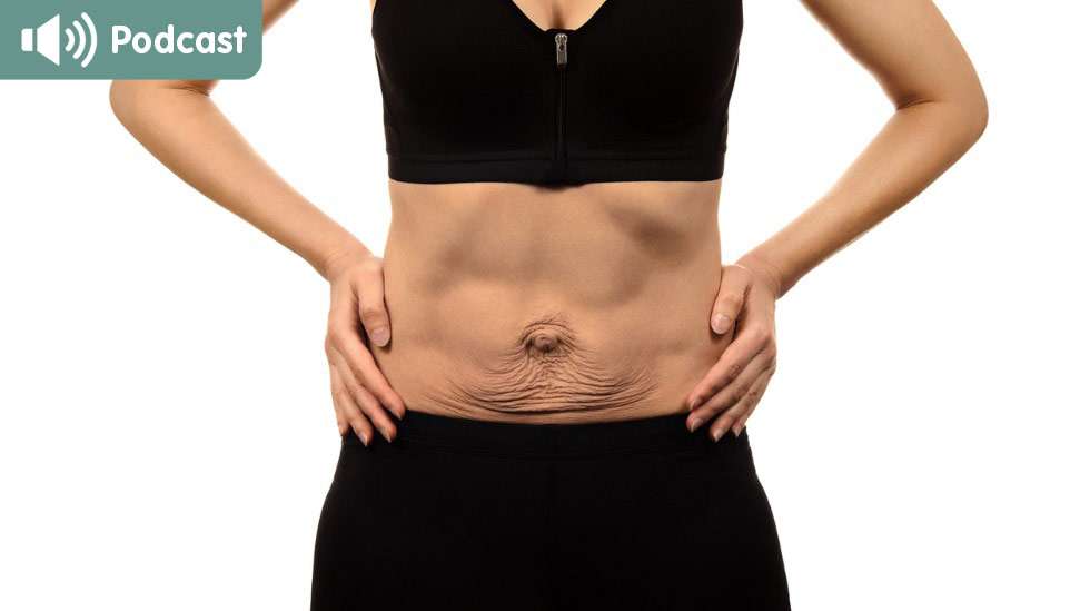 Raskauden aikana vatsan iho ja lihakset ovat venyneet kasvavan vatsan tieltä. Kun lapsi on syntynyt, keho alkaa hitaasti palautua. Kuva: iStock