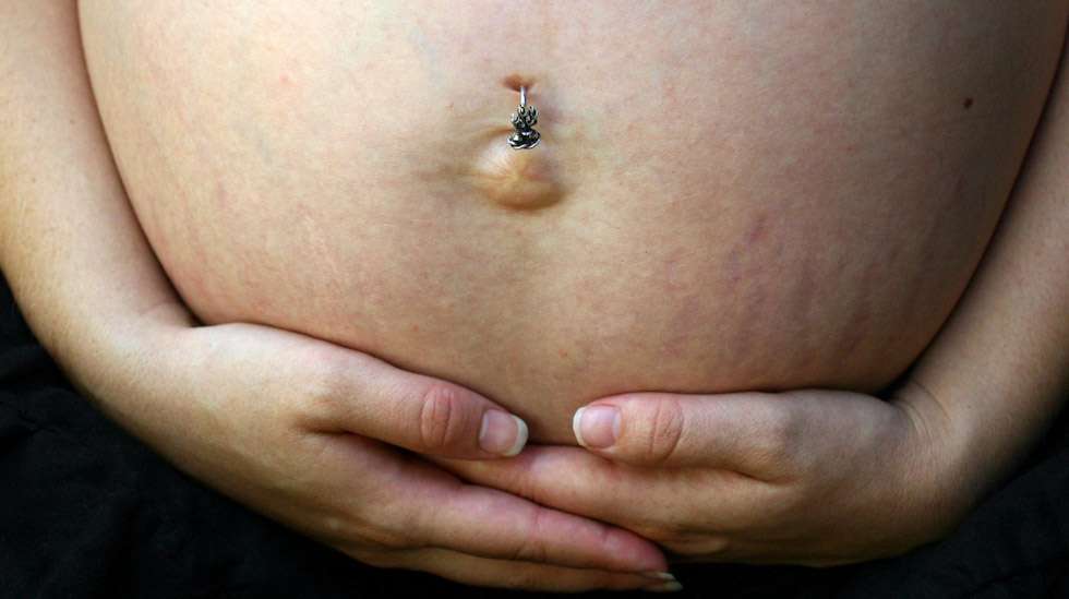 Napakoru voi hankaloittaa synnytystoimenpiteitä, kuten hätäsektiota tai istukan irrotusta. Kuva: iStock